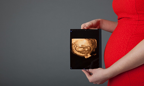 pemeriksaan kehamilan usg 4d, pemeriksaan kehamilan, rumah sakit awal bros, rs awal bros