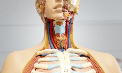 penyebab kanker tiroid, rumah sakit awal bros