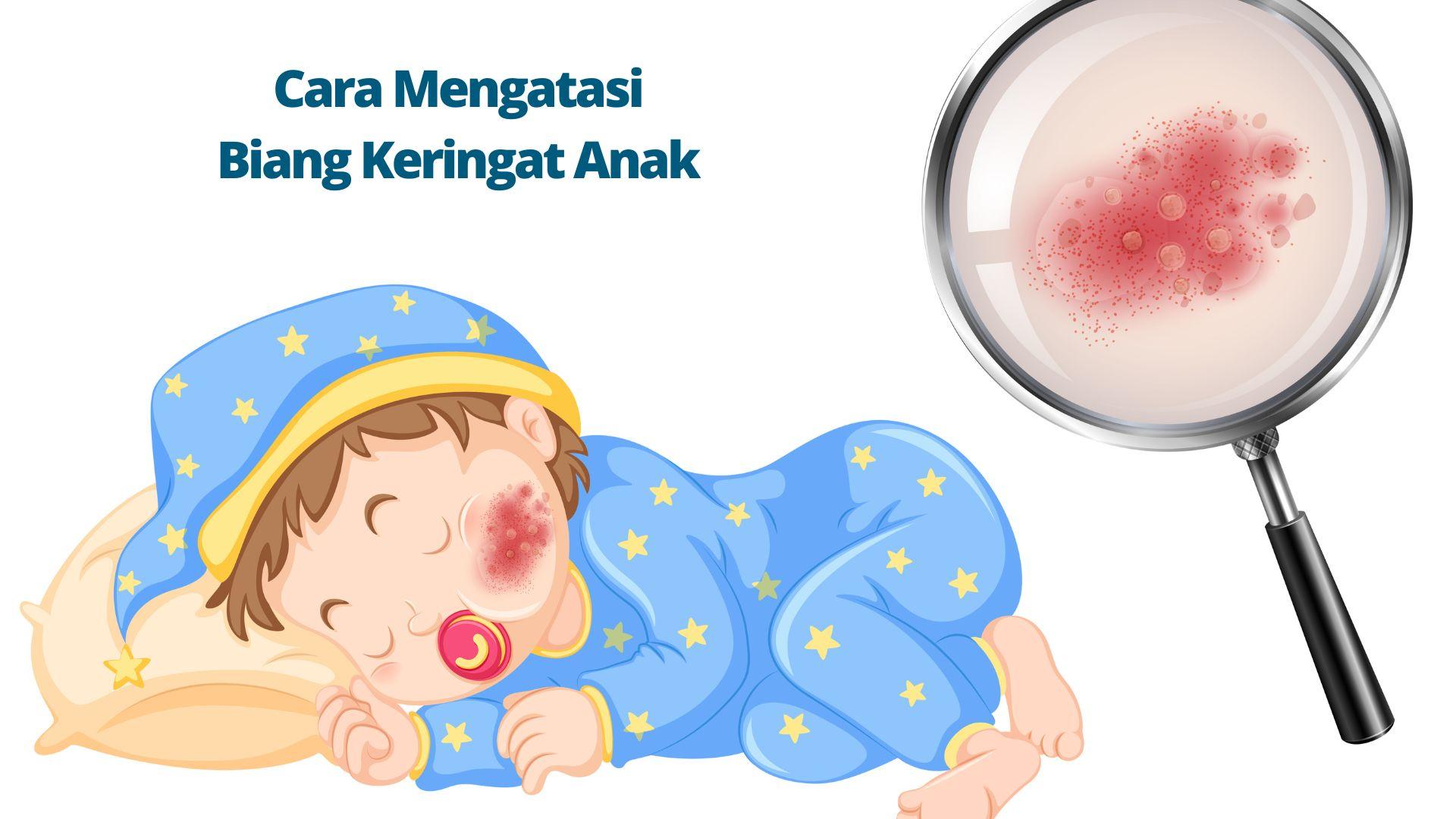 Cara Mengatasi Biang Keringat Anak