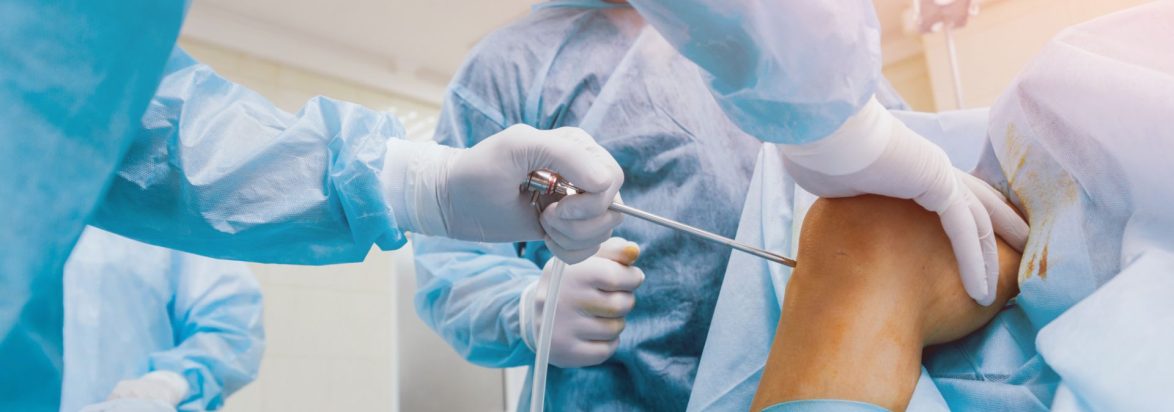 Artroskopi Arthroscopy