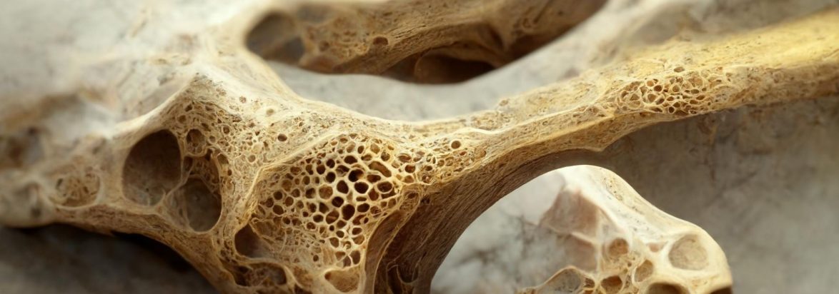 Bone Mineral Densitometri - Tes Kepadatan Tulang