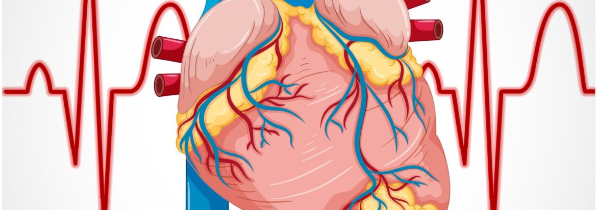 IVUS (Intravascular Ultrasound) Diagnosis Penyakit Pembuluh Darah