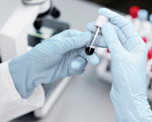 Preimplantation Genetic Testing