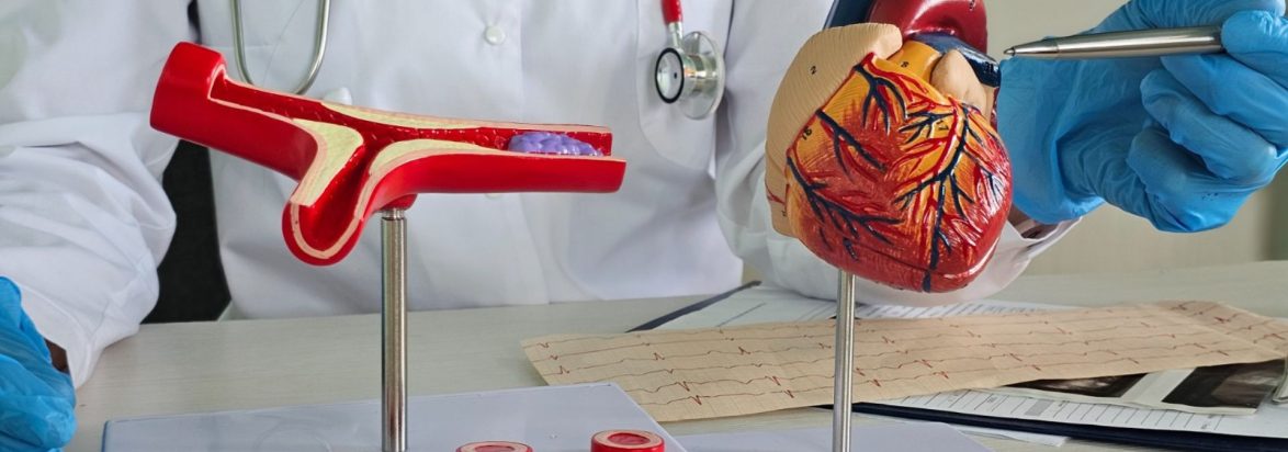 Intravascular lithotripsy