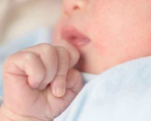 ruam kulit pada bayi