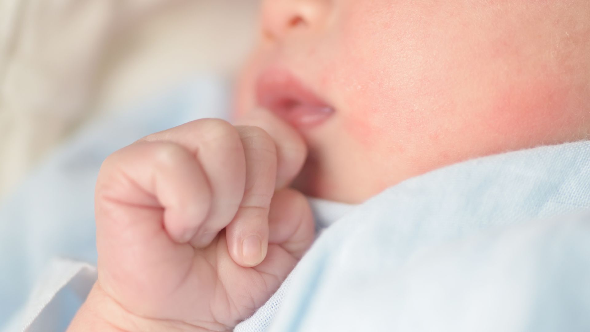 ruam kulit pada bayi